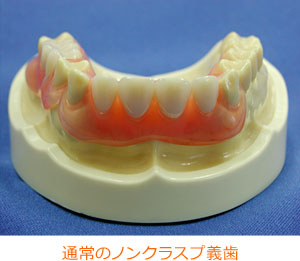 通常のノンクラスプ義歯