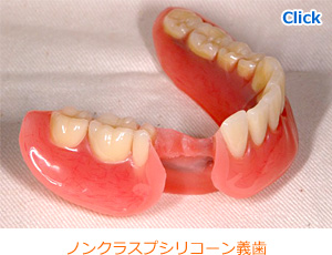 高精密なノンクラスプシリコーン義歯