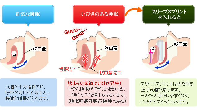 スリープスプリントの効果